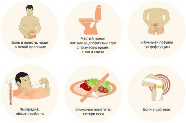 Симптомы колита кишечника