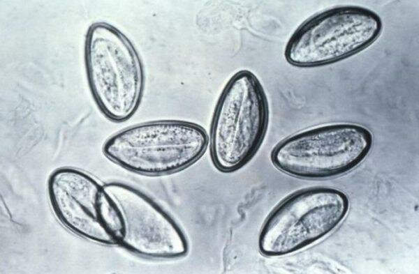 Яйца остриц под микроскопом